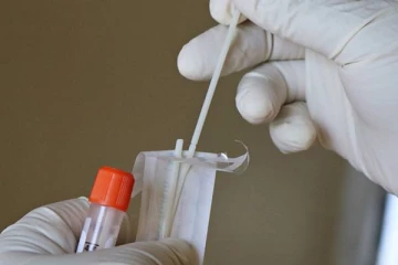 பிசிஆர், ஆன்டிஜென் பரிசோதனைகளுக்கு நிர்ணைய விலை