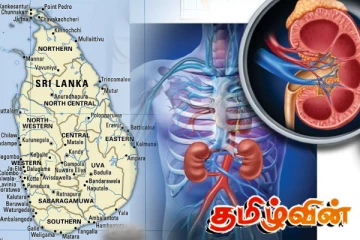 இலங்கையில் பதிவாகும் சிறுநீரக நோயாளிகள் தொடர்பில் வெளியான தகவல்