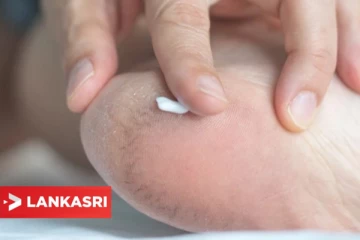 கால்களை அசிங்கமாக்கும் பித்த வெடிப்பை தடுக்க வேண்டுமா? இதோ சூப்பரான வழிகள்