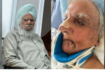 கனடாவில் நோயாளி ஒருவரின் தடியை சவரம் செய்ததனால் எழுந்துள்ள சர்ச்சை