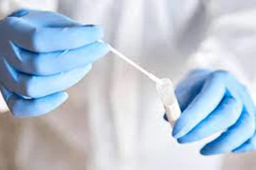 இந்த வாரத்தில் சுவிட்சர்லாந்தில் கொரோனா நிலைமை எப்படி உள்ளது?