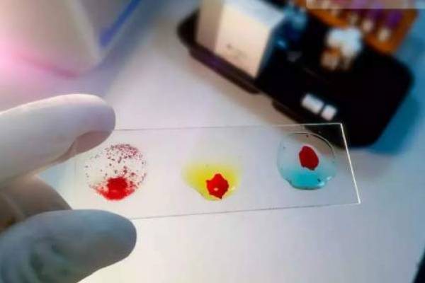 அரிய வகை ரத்தம்! உலகளவில் 10வது நபர் கண்டுபிடிப்பு | Unique Blood Group Person Found India