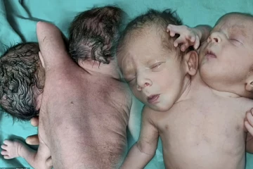 கர்ப்பத்தில் இரட்டைக் குழந்தைகள் இருப்பதாக நினைத்திருந்த பெற்றோருக்கு காத்திருந்த பயங்கர அதிர்ச்சி