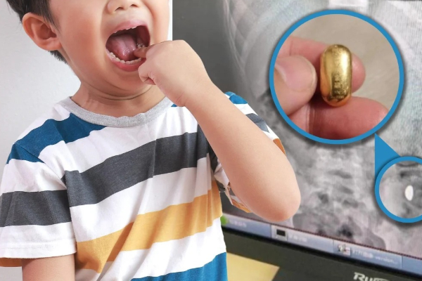 சீனாவில் தங்கத்தை விழுங்கிய சிறுவன் ; 5 நாட்கள் மகனை வீட்டுக்குள் அடைத்த தாய் | Boy Swallo Gold China Mother Locks Son House5 Days சீனாவில் தங்கத்தை விழுங்கிய சிறுவன் ; 5 நாட்கள் மகனை வீட்டுக்குள் அடைத்த தாய் | Boy Swallo Gold China Mother Locks Son House5 Days