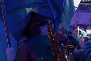 அறுவை சிகிச்சையின்போது நோயாளி செய்த விசித்திர செயல்!