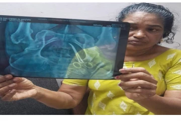 5 ஆண்டுகளாக வயிற்று வலியால் தவித்துவந்த பெண்: எக்ஸ்ரேயில் தெரிந்த அதிரவைத்த காட்சி