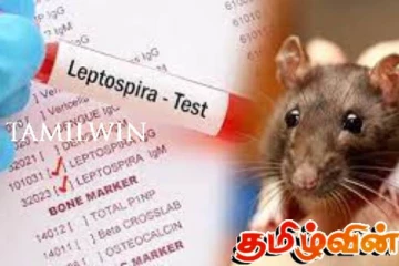 எலிக்காய்ச்சல் குறித்து விடுக்கப்பட்டுள்ள எச்சரிக்கை!