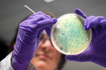 பிரித்தானியாவில் இறைச்சி உணவுப்பொருட்கள் மூலம் பரவும் நோய்க்கிருமி தொற்று அதிகரிப்பு