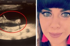 கர்ப்ப சோதனைக்கு சென்ற பெண்ணுக்கு காத்திருந்த இன்ப அதிர்ச்சி! ஸ்கேனில் அவர் கண்ட எதிர்பாரத காட்சி: வைரலாகும் புகைப்படம்