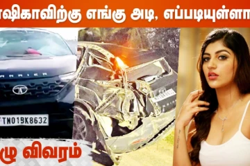 யாஷிகாவிற்கு எங்கு அடி, எப்படியுள்ளார்!