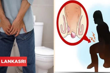 எவருக்கும் மூலநோய் வரலாம்! ஓர் எச்சரிக்கை வீடியோ