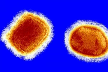 கொரோனாவை அடுத்து குரங்கம்மை! 14 நாடுகளில் பரவல் !