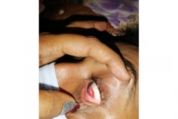 அழைத்து தாக்கிய பொலிஸார் - மட்டக்களப்பில் குடும்பஸ்தர் படுகாயம்