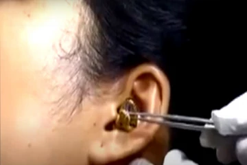 பெண்ணின் காதுக்குள் புகுந்த பாம்பு! வெளியான பகீர் காணொளி!