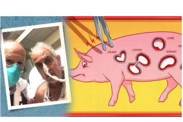 பன்றியின் இதயம் மனிதர்களுக்கு பொருந்தியது ஏன்? ஆச்சரியத்தை ஏற்படுத்திய சம்பவம்