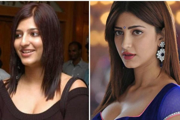 நான் என்ன செய்தால் உங்களுக்கு என்ன!! பிளாஸ்டிக் சர்ஜரி குறித்து கத்திய கமல் மகள் ஸ்ருதி. | Shruti Hassan Says She Got Her Nose Fixed