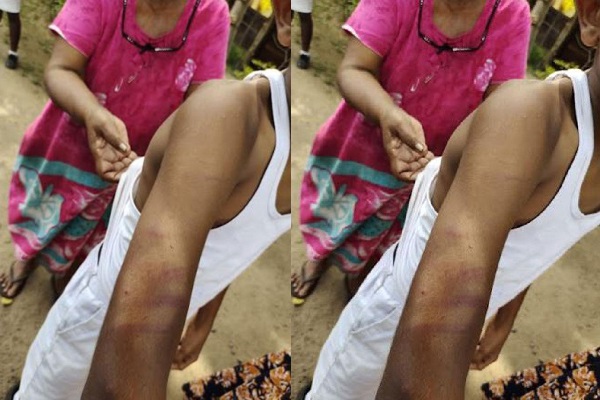 மாணவன் மீது கொடூர தாக்குதல் -ஆசிரியர் கைது (படங்கள்) | Teacher Brutally Assaulted A Student Arrested