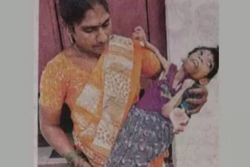 விதித்திர நோயால் எலும்பு கூடாக உள்ள 16 வயது சிறுமி!