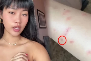 பிரான்ஸ் ரயில்களில் மூட்டைப்பூச்சித் தொல்லை இருப்பது உண்மைதான்... ஆதாரத்தை வெளியிட்டுள்ள இளம்பெண்