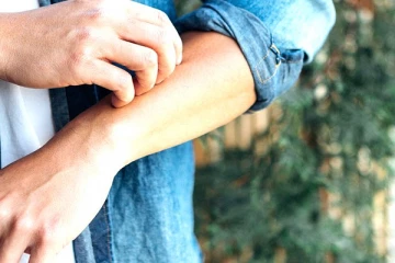 குரங்கு அம்மை பாதிப்பிலிருந்து நாம்  எப்படி பாதுகாத்து கொள்ளலாம்?