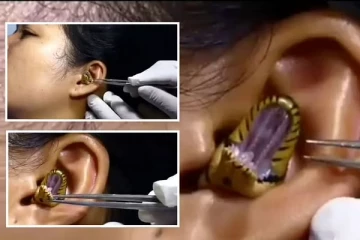 பெண்ணின் காதுக்குள் புகுந்த பாம்பு! நெஞ்சை பதைபதைக்கும் வீடியோ