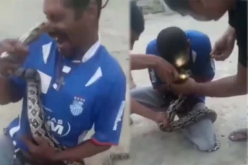 முத்தமா கொடுக்குற? நபரின் மூக்கை கடித்துக் குதறிய பாம்பு! பகீர் காட்சி