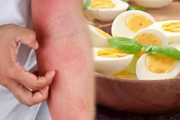 குரங்கு அம்மை தொற்றால் பயமா? கவலை விடுங்க.. எதிர்ப்பு சக்தியை அதிகரிக்க இந்த உணவுகளை எடுத்துகோங்க