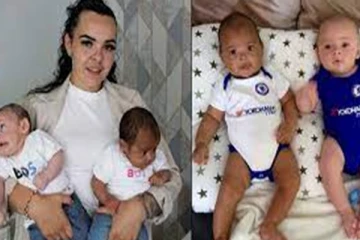 வெவ்வேறு நிறத்தில் பிறந்த இரட்டைக் குழந்தைகள்... அதிர்ச்சியில் தாய்