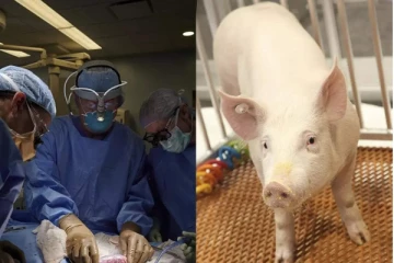 பன்றியின் சிறுநீரகத்தை மனிதனுக்கு பொருத்தி சாதனை