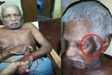 யாழில் முதியவர் மீது கொடூர தாக்குதல்: காவல்துறையில் முறைப்பாடு(படங்கள்)