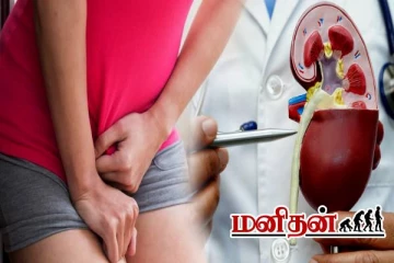 ஆண்களே உஷாரா இருங்க.. சிறுநீர் கழிக்கும் பொழுது ஏன் எரிச்சல் தெரியுமா?