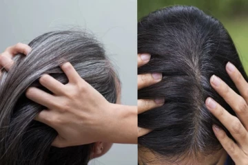 நரை முடியை மீண்டும் கருப்பாக்கலாம் - விஞ்ஞானிகளின் அசத்தல் கண்டுபிடிப்பு!