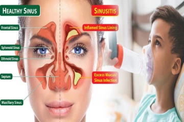சைனஸ் மற்றும் ஆஸ்துமா பிரச்சனையில் இருந்து எப்படி விடுபடுவது ?