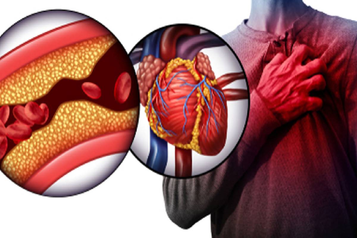 உயிரை பறிக்கும் இதய நோய்கள்: இந்த அறிகுறி இருக்கா? இந்த உணவுகளை தவிர்க்காதீர்! | Heart Disease Causes Which Foods Prevent Naturally