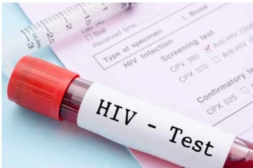 எயிட்ஸ் தொற்றுக்குள்ளானோருக்கான முக்கிய அறிவுறுத்தல்