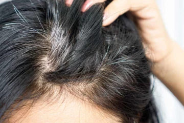 வெள்ளை முடி பிரச்சனையை குறைக்கும் வீட்டு வைத்தியம் - எப்படி தெரியுமா?