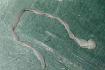 பல ஆண்டுகளாக உடல் நலம் பாதிக்கப்பட்டிருந்த பெண்: தெரியவந்த திடுக்கிடவைக்கும் உண்மை