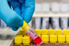 திருகோணமலையில் கடந்த 24 மணித்தியாலங்களில் 9 புதிய தொற்றாளர்கள் அடையாளம்