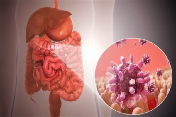 வயிற்று புற்றுநோயின் ஆரம்ப அறிகுறிகள் என்ன? இதை மட்டும் புறக்கணிக்காதீங்க | Stomach Cancer Serious Symptoms In Tamil வயிற்று புற்றுநோயின் ஆரம்ப அறிகுறிகள் என்ன? இதை மட்டும் புறக்கணிக்காதீங்க | Stomach Cancer Serious Symptoms In Tamil