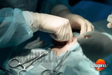 උපත් පාලන ලූපය ඉවත් කරගන්න පැමිණි මව වෛද්‍යවරයා විසින් දූෂණය කරයි