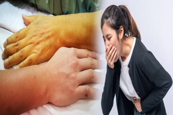 இந்த 4 அறிகுறிகள் இருக்கா? உங்க கல்லீரலை பத்திரமா பாத்துகோங்க | A Sign Of Liver Damage Should Never Ignore Tamil இந்த 4 அறிகுறிகள் இருக்கா? உங்க கல்லீரலை பத்திரமா பாத்துகோங்க | A Sign Of Liver Damage Should Never Ignore Tamil