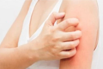 உடல் முழுவதும் ஏற்படும் எரிச்சலுக்கு இதை மட்டும் செய்யுங்க