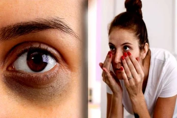 கண்ணை சுற்றி கருவளையம் உள்ளதா? இனி உங்களுக்கு கவலையே இருக்காது..சூப்பரான ஹோம் ரெமடி!