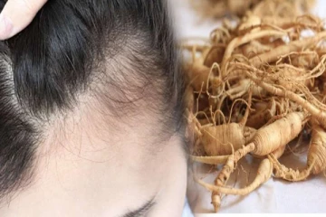 தலையில் முடியே இல்லாமல் சொட்டையா இருக்கா? இந்த 3 பொருள் வைத்து மசாஜ் செய்ங்க வளரும்