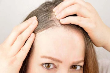 இளம் வயதில் தாறுமாறாக முடி கொட்டுகின்றதா? வழுக்கை விழ காரணம் இதுதான்