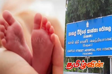 காசல் மகளிர் வைத்தியசாலையில் ஒட்டி பிறந்த இரட்டை குழந்தைகள்