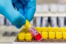 மட்டக்களப்பு போதனா வைத்தியசாலையில் 21 சுகாதாரத் துறையினருக்கு கொரோனா தொற்று