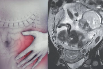 வயிற்றுவலியுடன் மருத்துவமனைக்கு சென்ற இளம்பெண்: மருத்துவர்களே எதிர்பார்க்காத அதிர்ச்சி