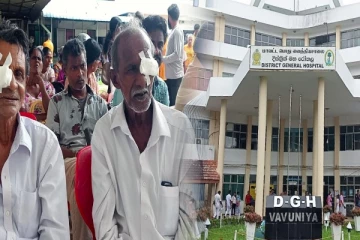 வடக்கு மாகாணத்தில் இலவச கண் சிகிச்சை: இரண்டாம் கட்ட நடவடிக்கை ஆரம்பம்