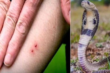 தமிழர் பகுதியில் பாம்புக்கடிக்கு இலக்கான இளைஞன் பரிதாபகரமாக உயிரிழப்பு